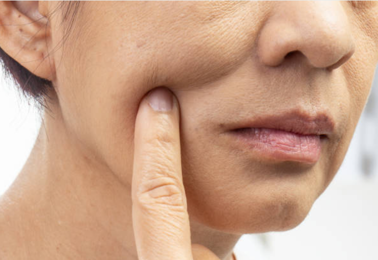 ほうれい線のケア方法