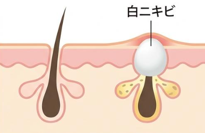 使用感タイムライン図解