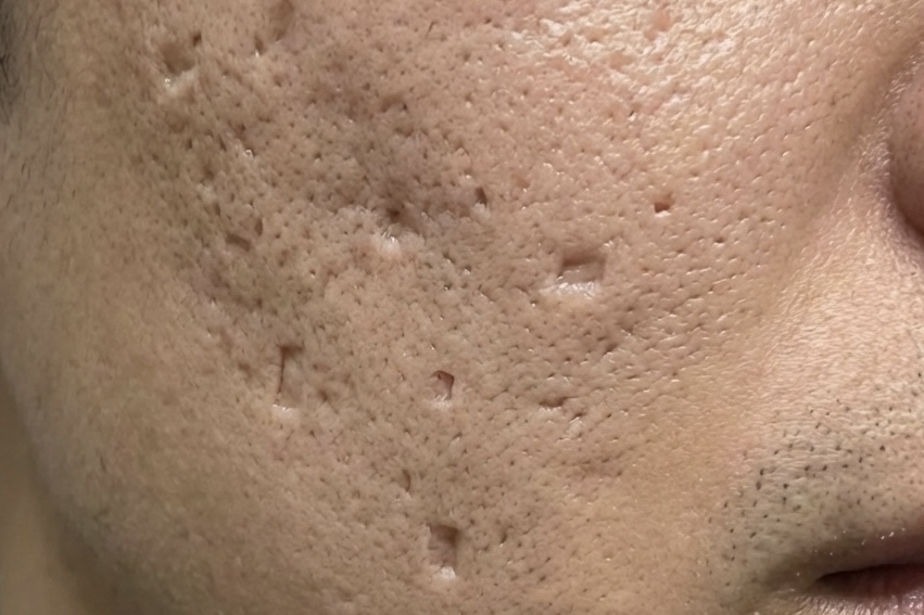 ボックスカー型クレーターのイメージ