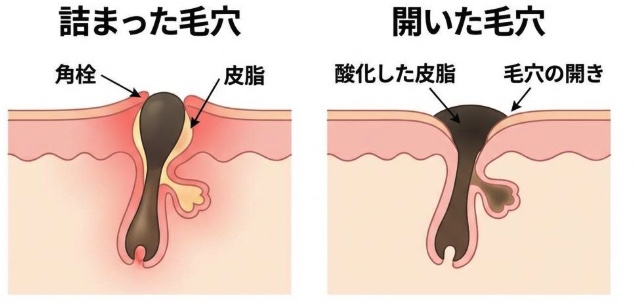 グリシルグリシンのメカニズム