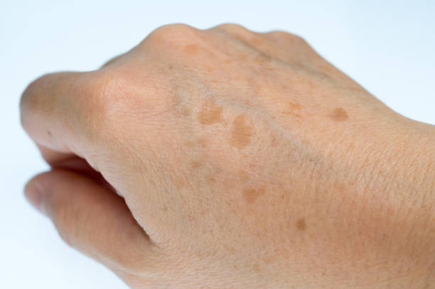 手の甲のスキンケアのイメージ