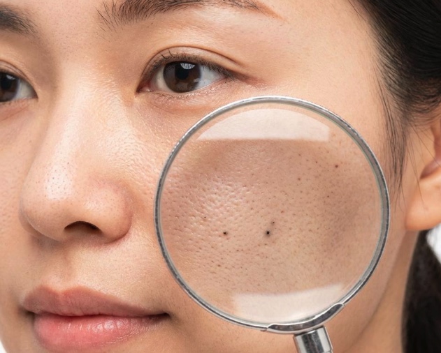 頬の毛穴を虫眼鏡で拡大して見つめるイメージ