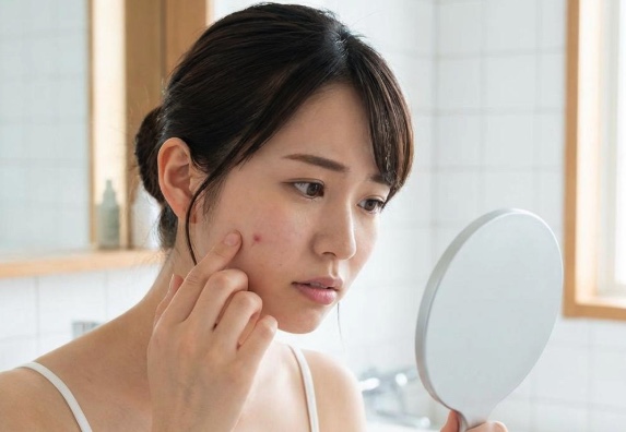 アゼライン酸は濃度何％から選ぶ？市販化粧品とクリニック処方の違いを徹底解説